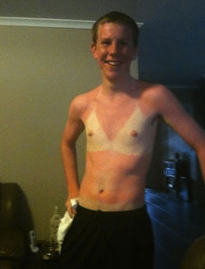 Diferencias playa en el norte o en el sur portada guiri quemado